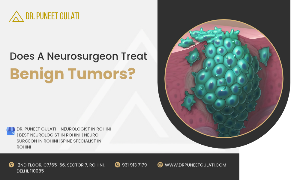 Does A Neurosurgeon Treat Benign Tumors?