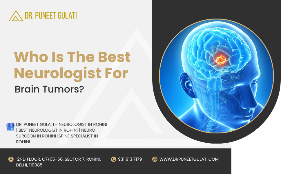 Who is the best neurologist for brain tumors?
